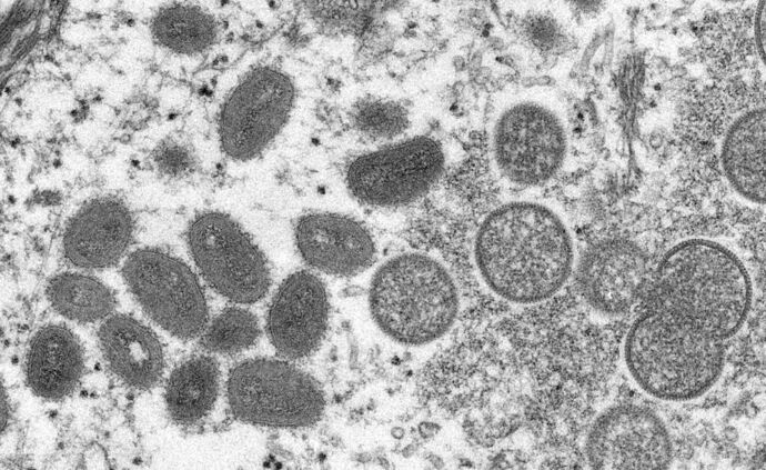 , Le Cambodge enregistre trois nouveaux cas de variole du singe